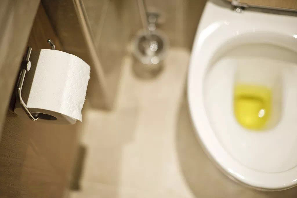 尿液变颜色可能是肾出了问题,赶紧自查一下!